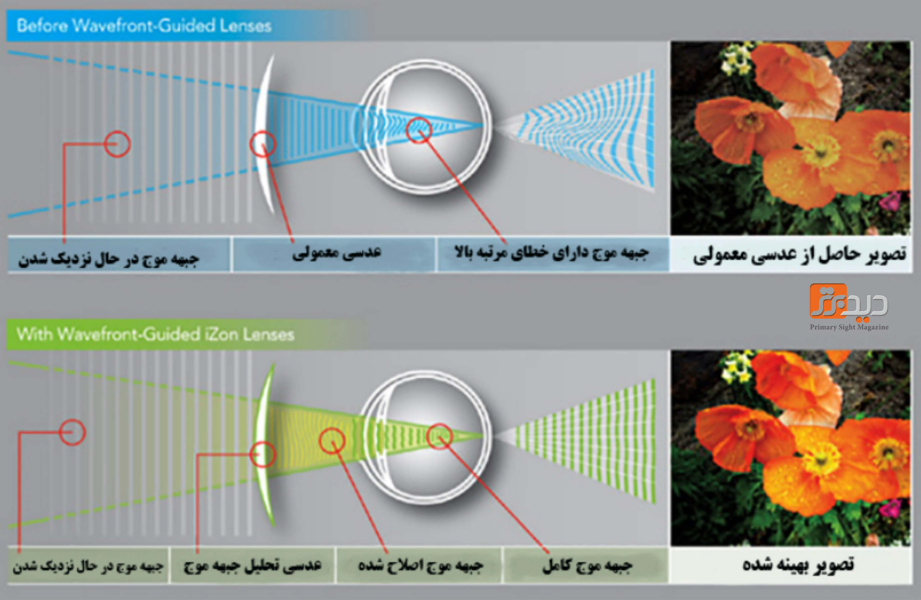 ساخت عدسی با فناوری جبهه موج